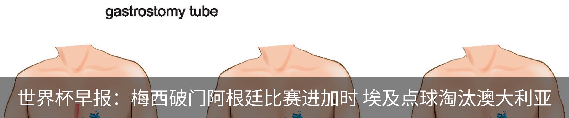 新闻中心
